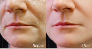 lady showing how uuth help her face appear younger.
